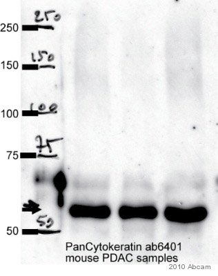 Anti-pan Cytokeratin antibody PCK-26 鼠单克隆[PCK-26
