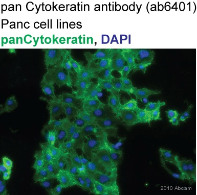 Anti-pan Cytokeratin antibody PCK-26 鼠单克隆[PCK-26