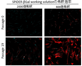 老化細胞検出キット Cellular Senescence Detection Kit - SPiDER-βGal　同仁化学研究所