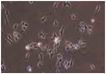 人iPS细胞来源的胆碱神经元祖细胞                              ReproNeuro Ach™ kit