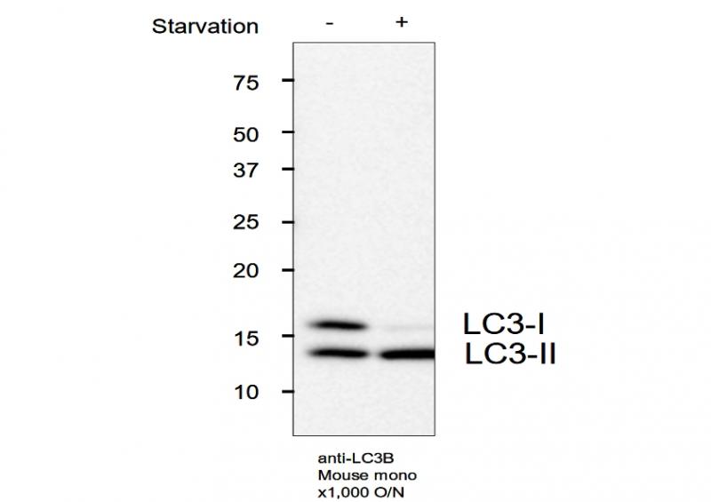 抗 LC3 单克隆抗体（克隆号：LC3.NO6）                              Anti LC3 (Clone: LC3.No.6) monoclonal antibody