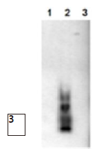 β淀粉样多肽                              Amyloid β