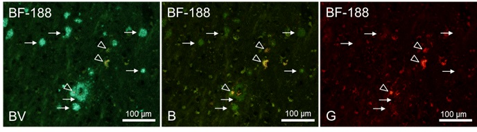 老年斑•神经原纤维缠结特异性探针BF-187，BF-188