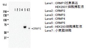抗CRMP5，单克隆抗体（KZ19）                              Anti CRMP5, Monoclonal   Antibody (KZ19)