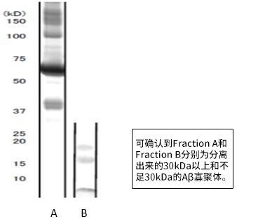 高分子β-淀粉样蛋白寡聚体 ELISA试剂盒Wako                              阿尔茨海默病研究用