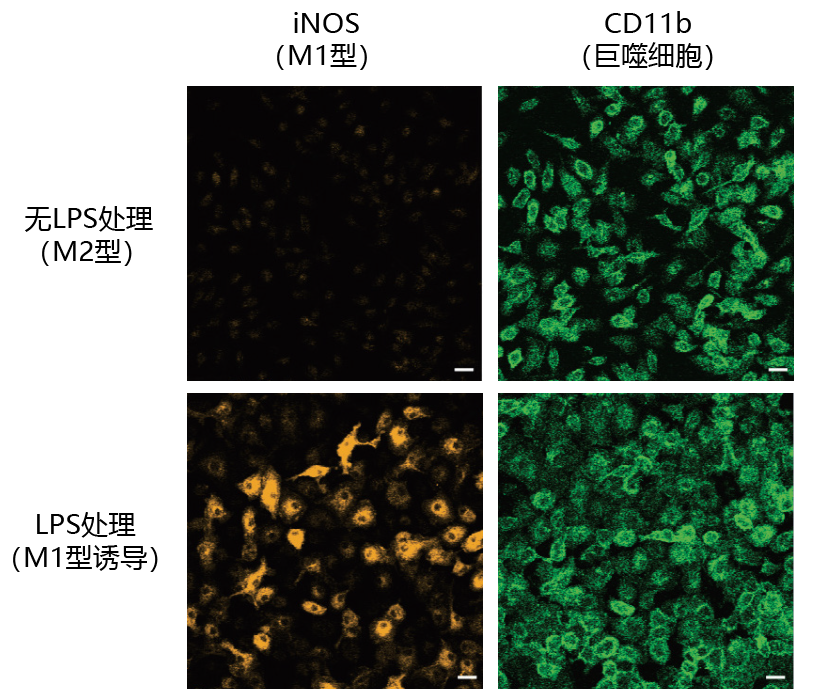 抗 iNOS 多抗 • 抗 Arg1 多抗                              应用于巨噬细胞的免疫细胞染色