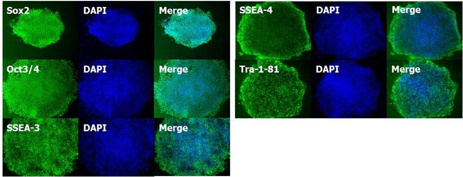 ES细胞・iPS细胞培养用血清代替品                              StemSure® Serum Replacement