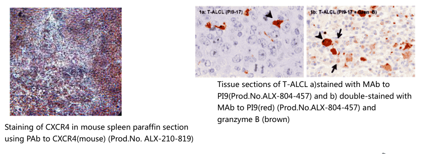 乳腺癌抗药性蛋白单克隆抗体（BXP-53）                              Breast cancer resistance protein, mAb (BXP-53)