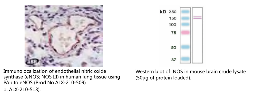 乳腺癌抗药性蛋白单克隆抗体（BXP-53）                              Breast cancer resistance protein, mAb (BXP-53)
