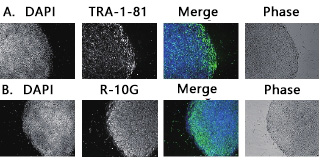 抗硫酸角质素单克隆抗体（R-10G）                              人iPS/ES细胞标记抗体