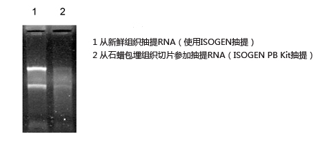 石蜡包埋组织切片RNA提取试剂盒                              ISOGEN PB Kit