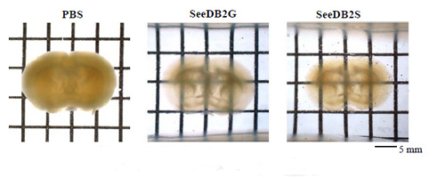 SeeDB2                              深层组织的高分辨率·高亮度分析
