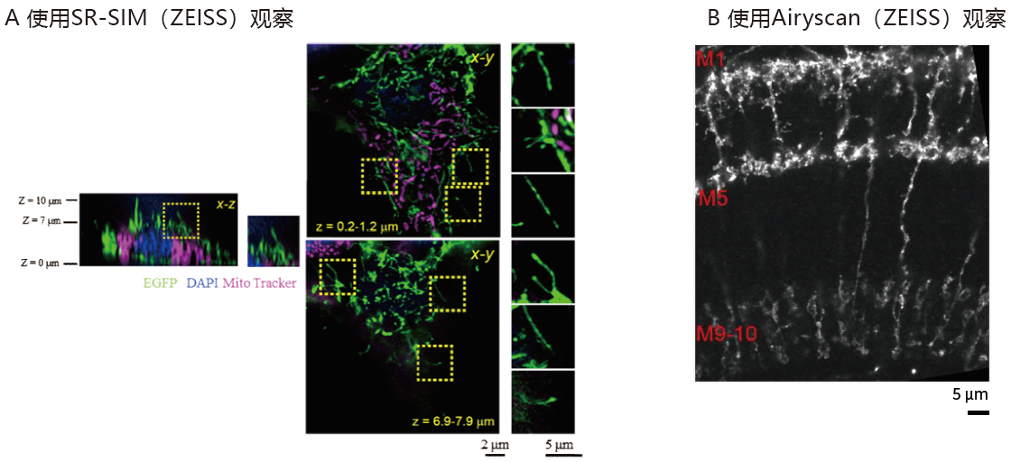Super Clear Mount封片剂                              荧光蛋白观察用、油浸物镜适用封片剂