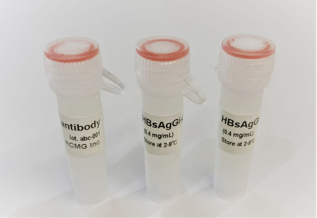 HBsAgGi抗体 & HBsAgGi ELISA试剂盒                              乙型肝炎病毒特异性检测