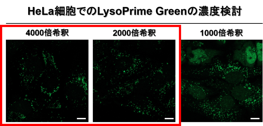 リソソーム染色色素 Green LysoPrime Green - High Specificity and pH Resistance　同仁化学研究所