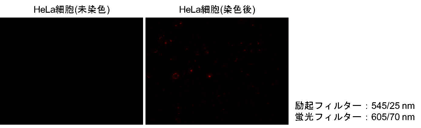 脂肪酸取り込み検出キット Fatty Acid Uptake Assay Kit　同仁化学研究所