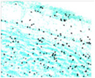 Engrafted Cell Markers